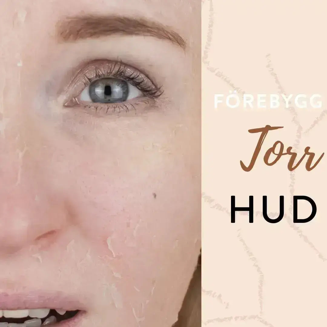 Torr hud i ansiktet med stram och flagande hud under vintertid