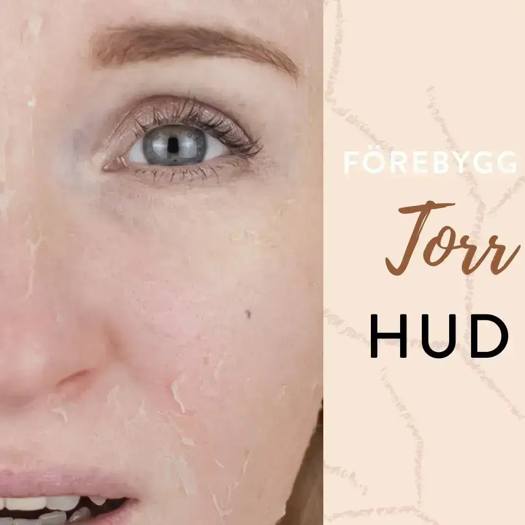 Torr hud i ansiktet med stram och flagande hud under vintertid